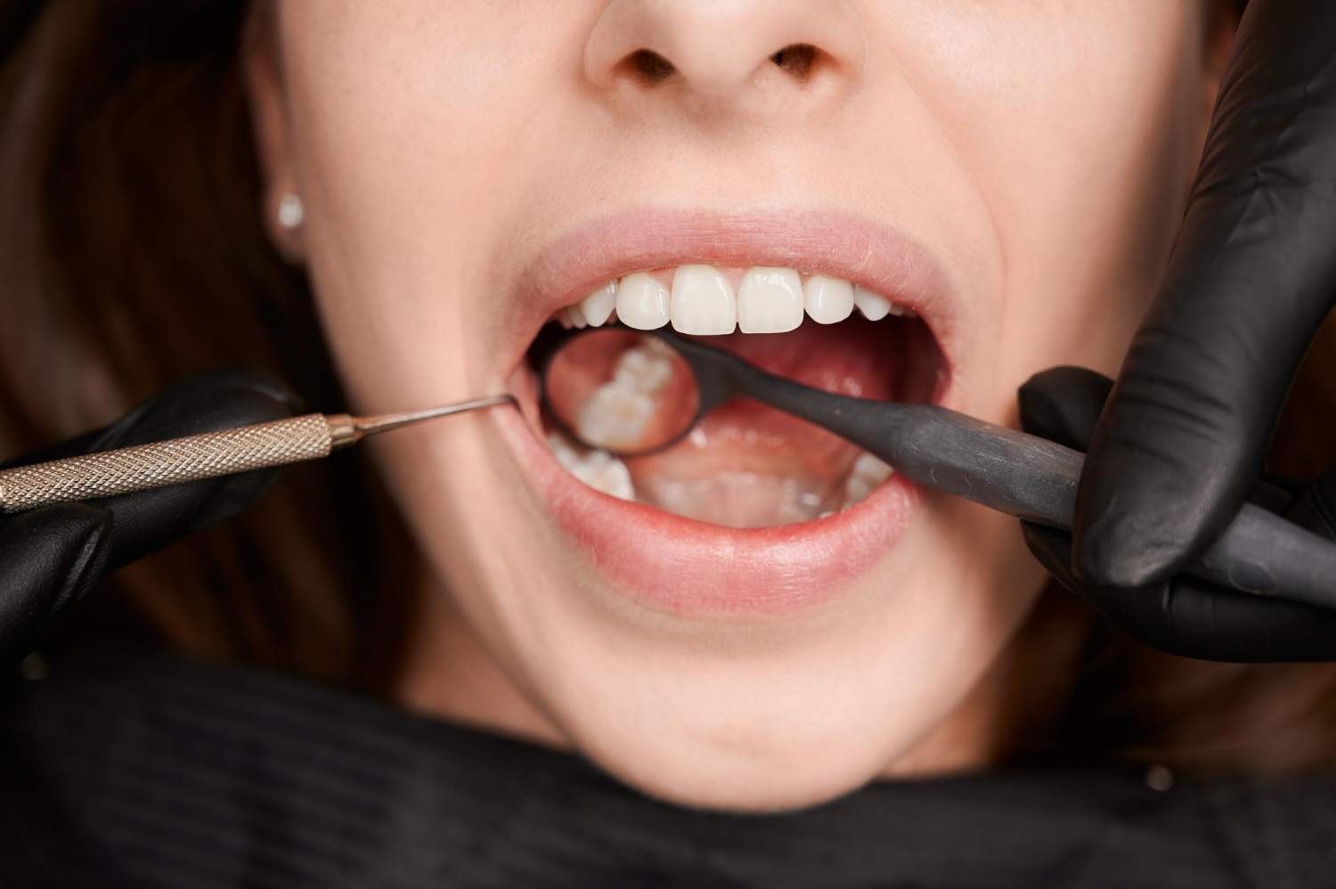 Endodoncia: el tratamiento que salva tus dientes dañados